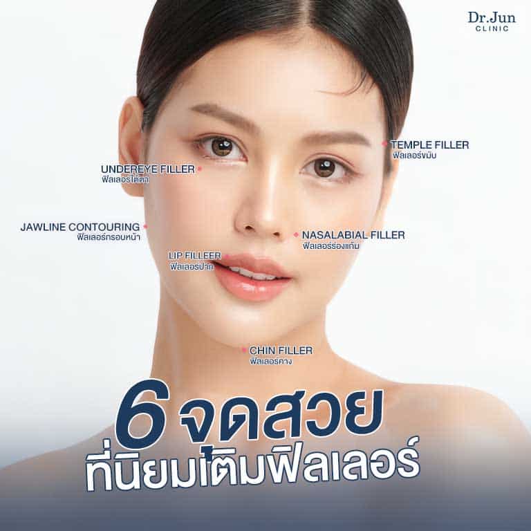 6 จุดยอดนิยมเติมฟิลเลอร์ Dr. Jun Clinic หมอจุนคลินิก
