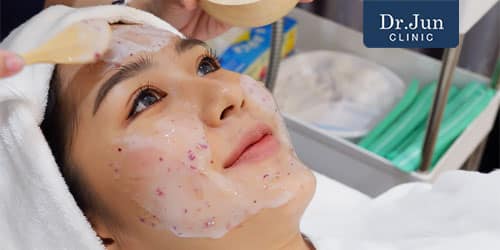 Acne-treatment