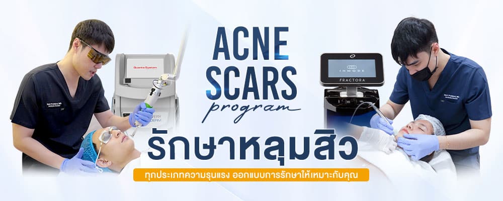 Dr. Jun Clinic รักษาหลุมสิว