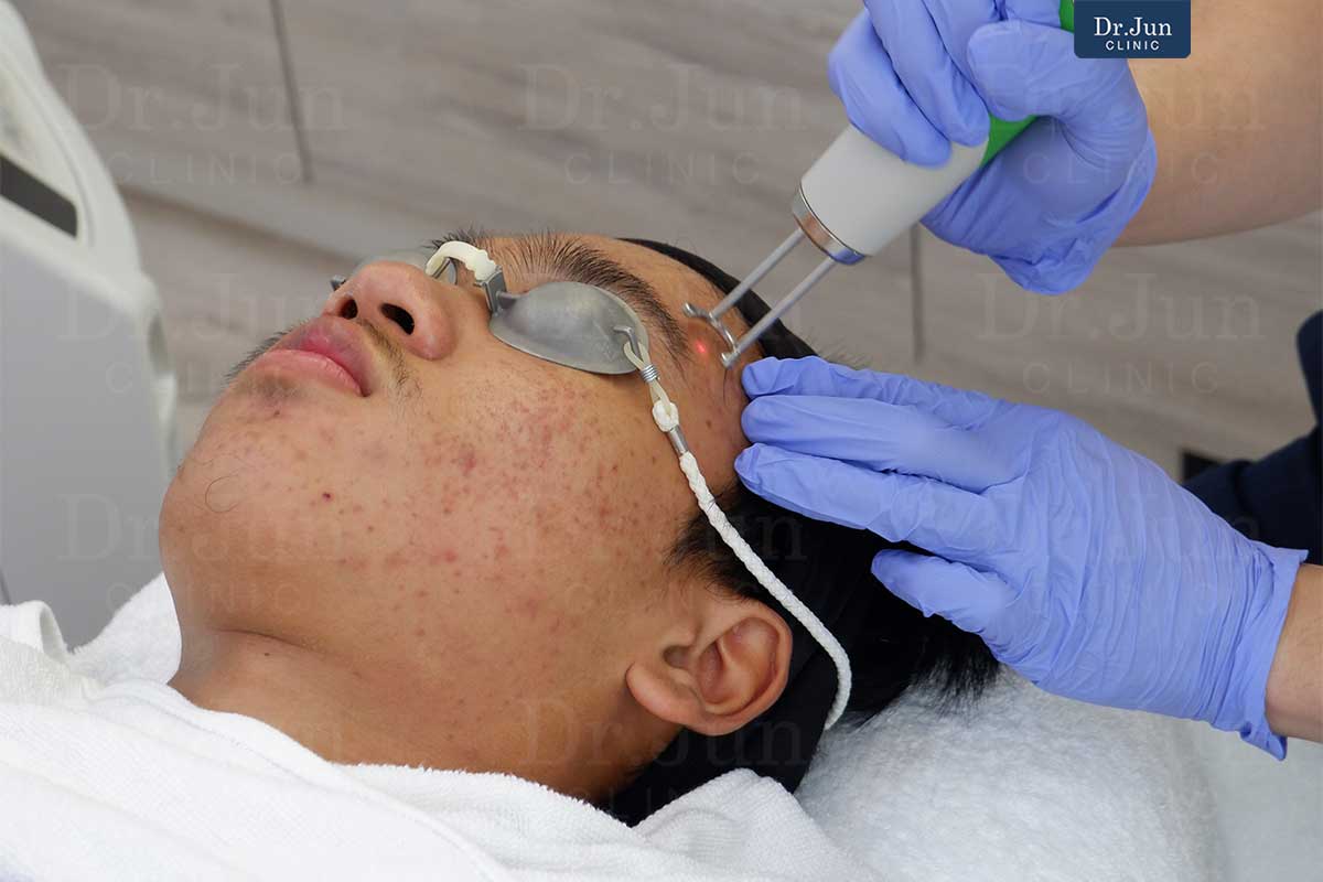 Discovery Pico Derm เลเซอร์คุณภาพสูงสลายเม็ดสี