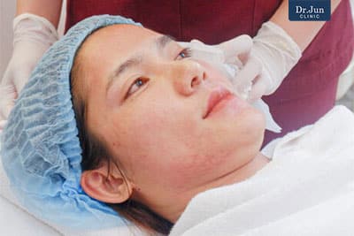 หลัทำการรักษาด้่วยเครื่อง Fractora หมอจุนคลินิก Dr. Jun clinic