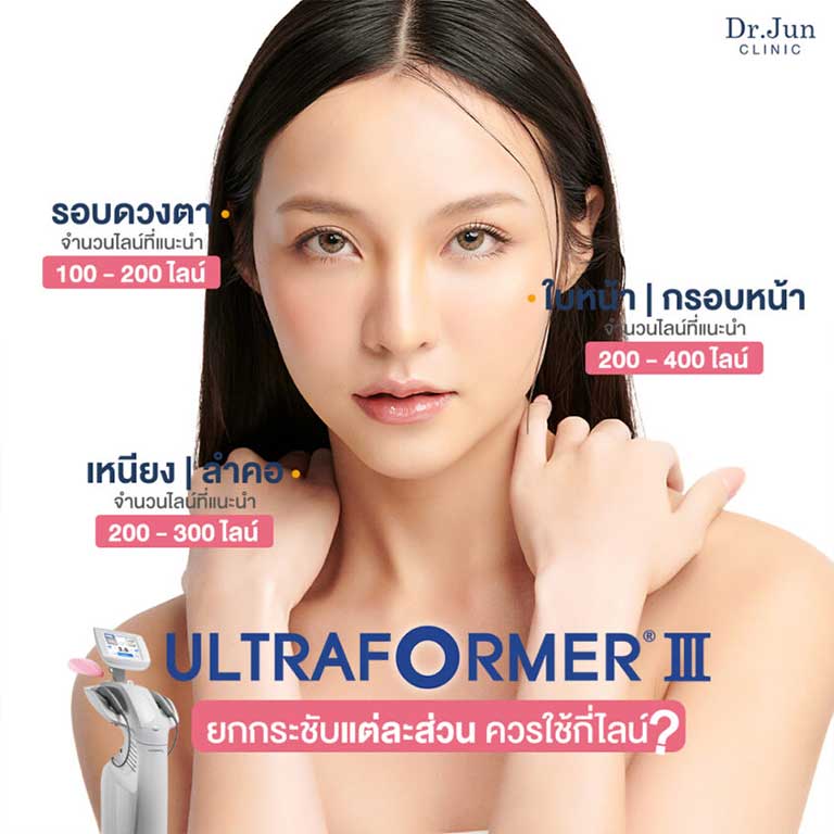 Ultraformer III ยกกระชับผิว แบบไม่ต้องผ่าตัด