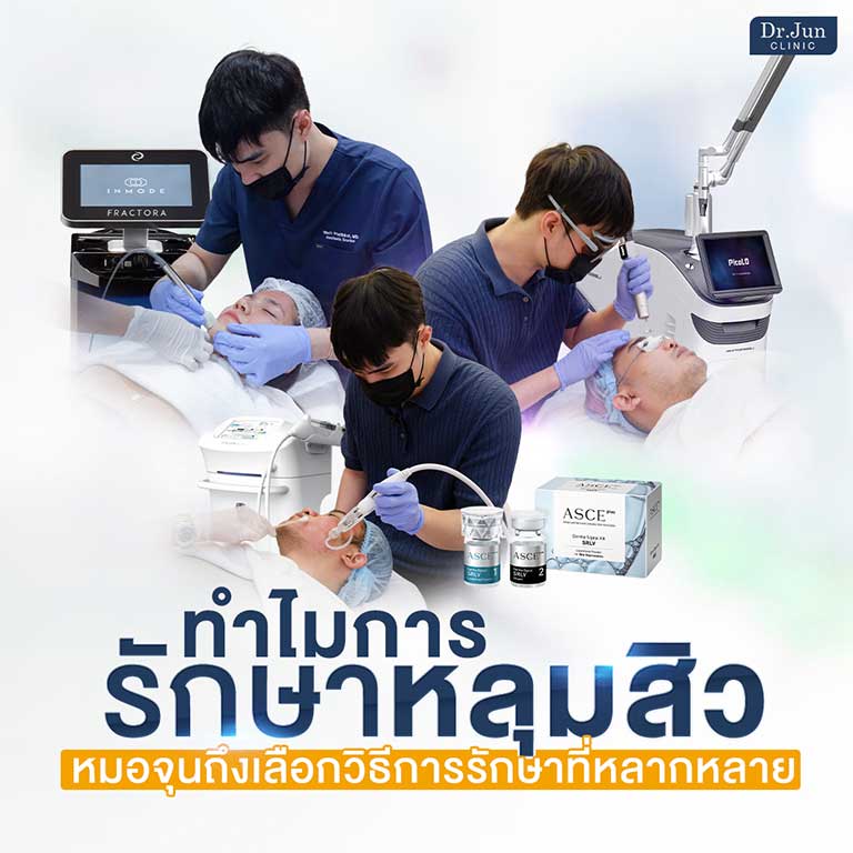 การรักษาหลุมสิว Dr. Jun Clinic หมอจุนคลินิก