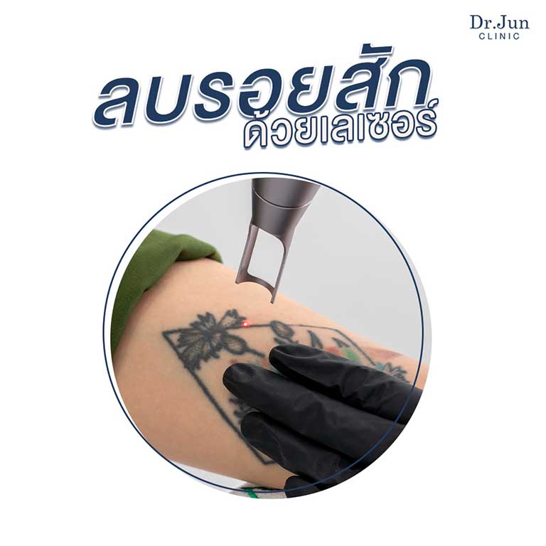 Dr. Jun clinic หมอจุนคลินิก รอยสัก