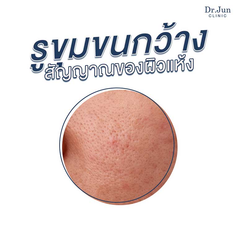 Dr. Jun clinic หมอจุนคลินิก รูขุมขนกว้าง