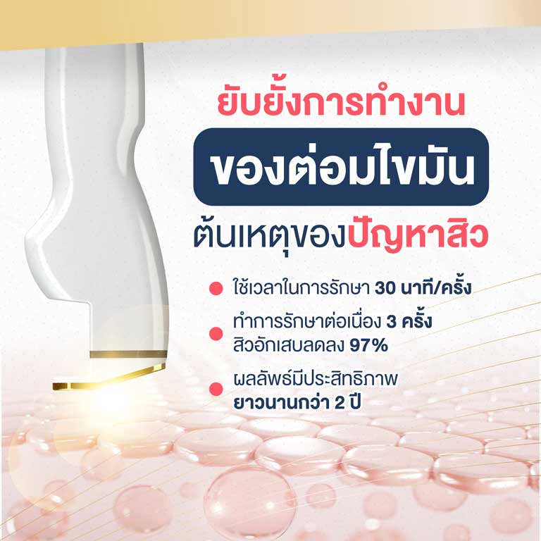 AviClear-Laser-ผลลัพธ์ที่ได้หลังจากการรักษา