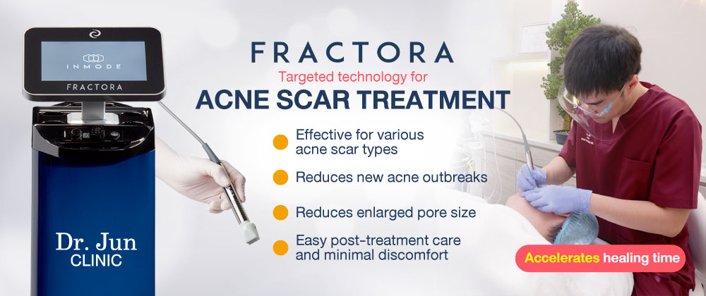 Fractora