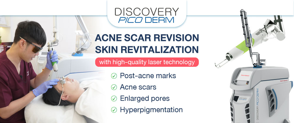 Discovery Pico Laser: Effective Treatment for Acne Scars, Melasma, Dark Spots