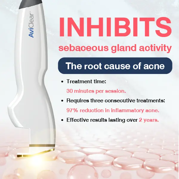 aviclear laser