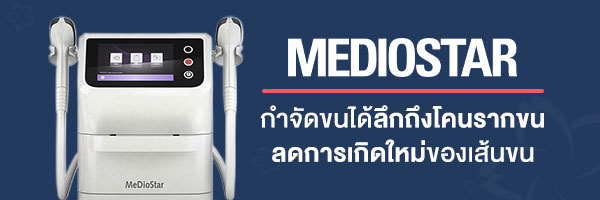 MeDioStar Monolith